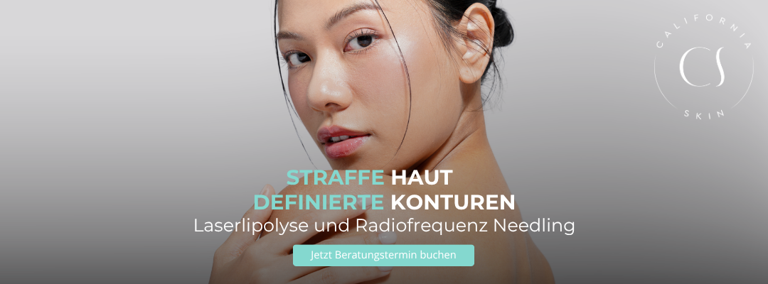 Laserlipolyse und Radiofrequenz Needling in Wiesbaden bei California Skin